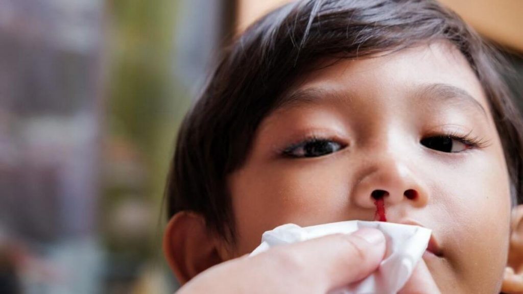 hidung budak berdarah