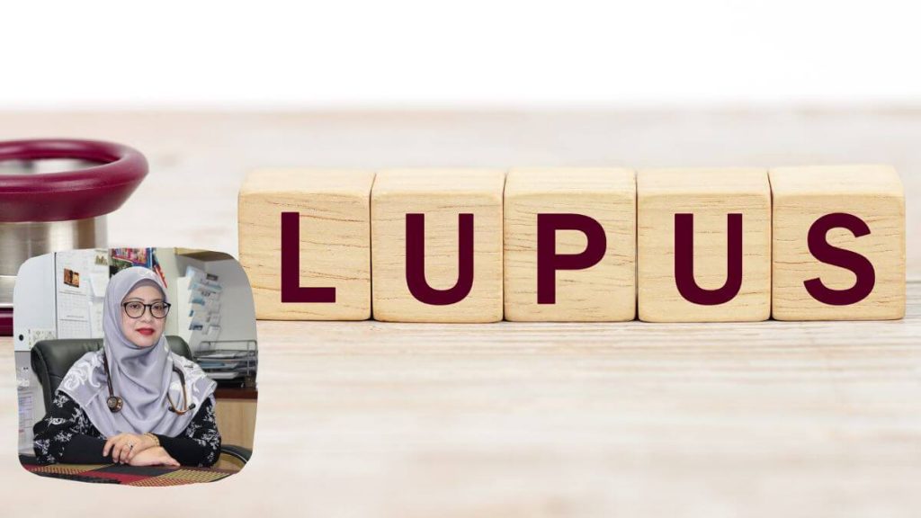 penyakit lupus